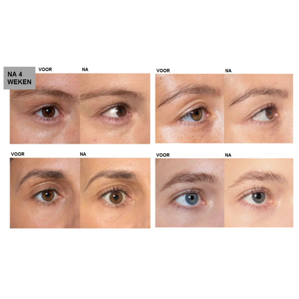 Lu0027Oréal Clinically Proven Wimperserum L'Oreal Lu0027Oréal Clinically Proven Wimperserum -Geselecteerde Mode-Cosmeticawinkels 994623 4